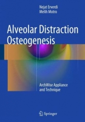 Alveolar Distraction Osteogenesis: ArchWise Appliance and Technique (pdf)